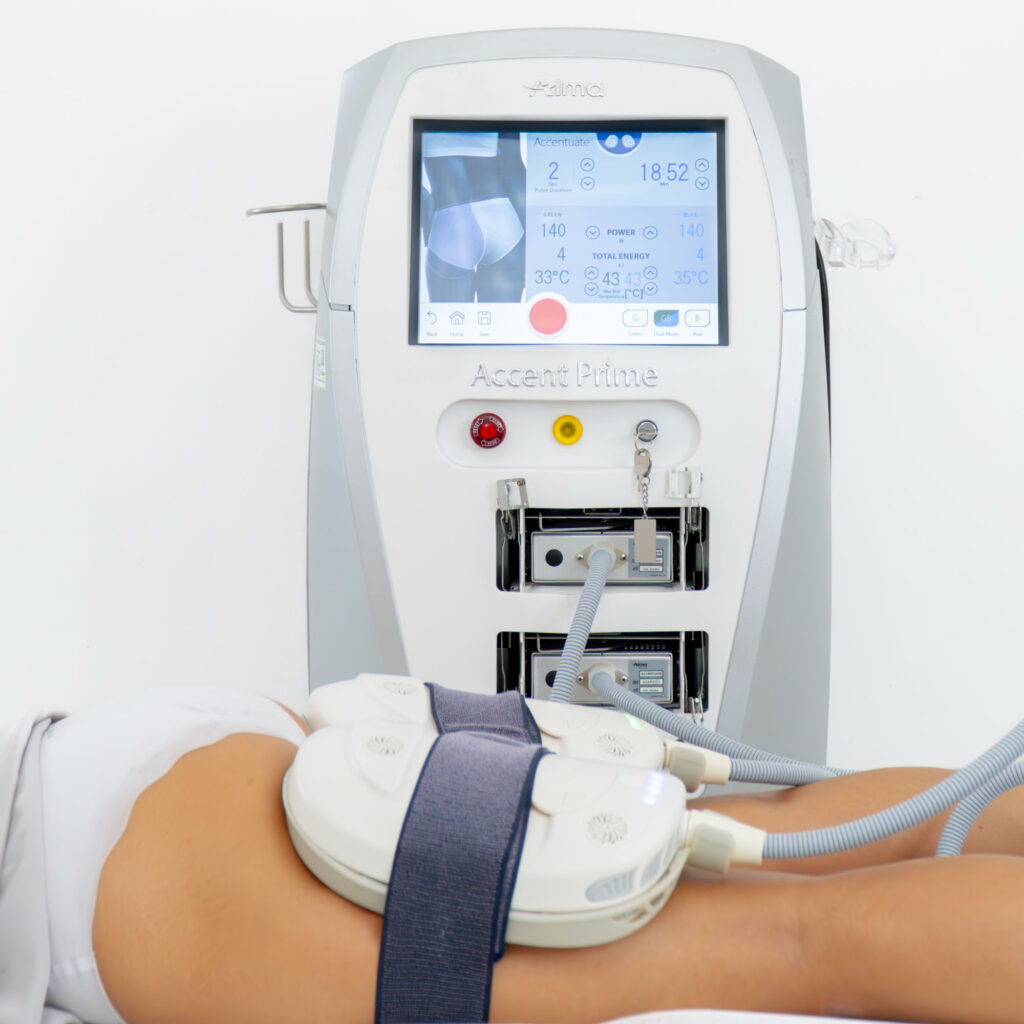 Alma Accent Prime — Body Lab Bali