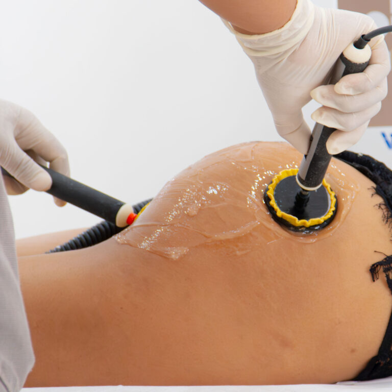 EMS | Glute Lift — Body Lab Bali