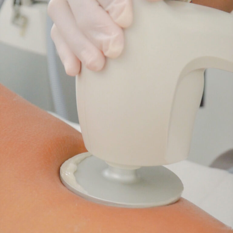 Lipo Sculpt — Body Lab Bali