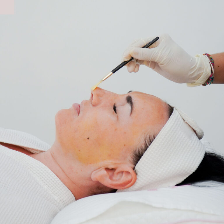 Retinol Peel — Body Lab Bali