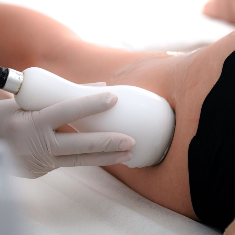 Super Cellulite Reduction — Body Lab Bali