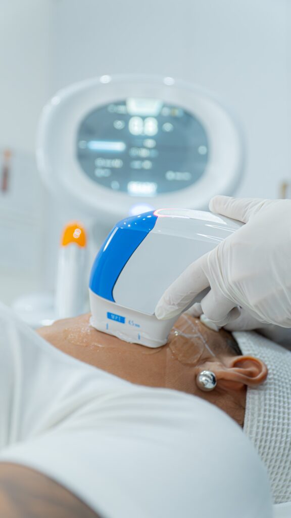 Ultraformer MPT — Body Lab Bali