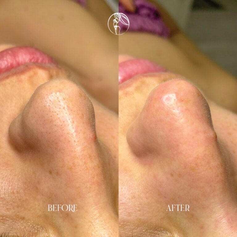 Deep Cleansing